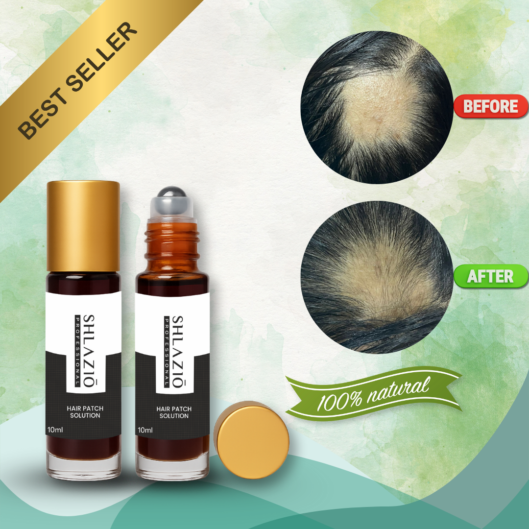 Alopecia Hair Patch Solution (10 ML ROLL-ON)