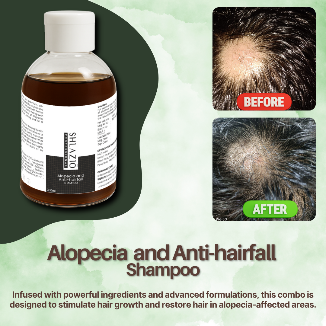 Alopecia Combo | Alopecia Oil + Shampoo | 10ml + 300ml