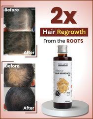 Natural Hair Regrowth Oil 200 ML