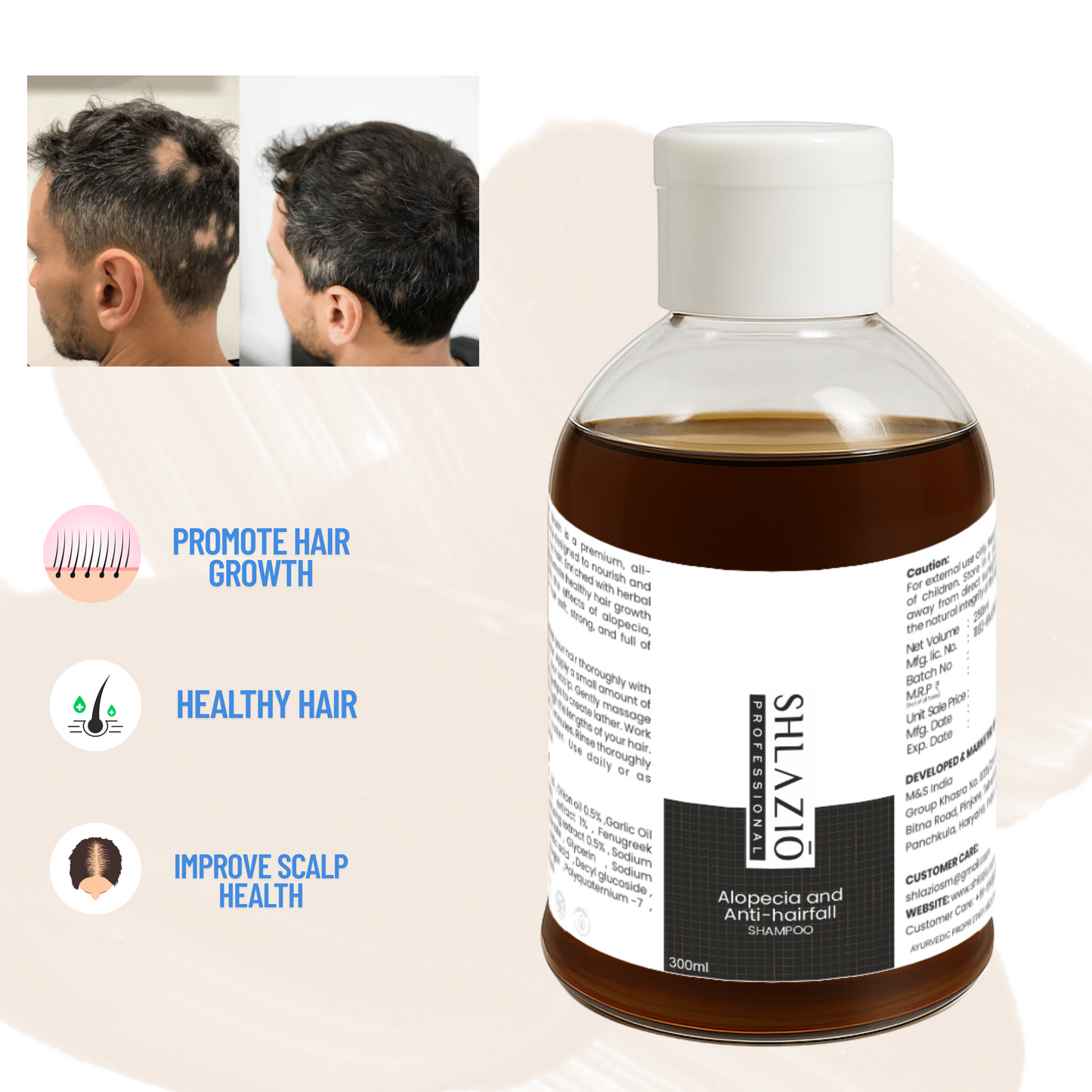Alopecia Shampoo