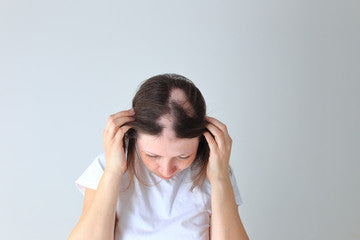 Battling Alopecia: Understanding Hair Loss and Finding Effective Solutions