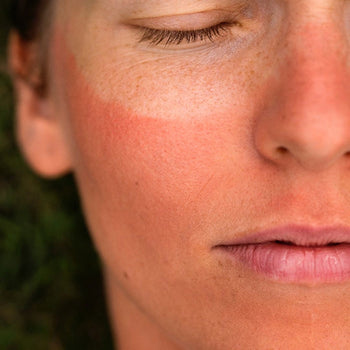Why Does Sunscreen Burn My Eyes? The Honest Answer Nobody Gives You