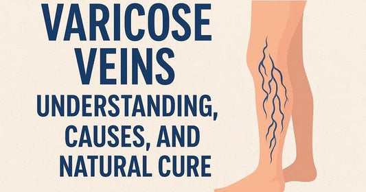 Varicose Veins: Understanding, Causes, and Natural Cure