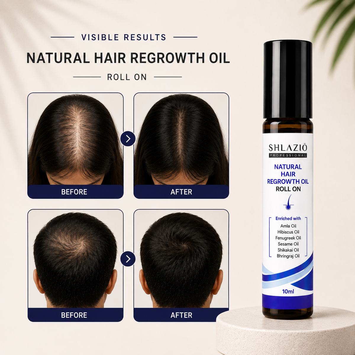 Natural Hair Regrowth Oil 10  ML RS 65 (PACK OF THREE) Rs195/-