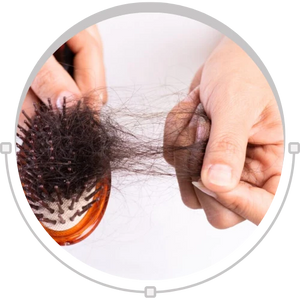 Telogen effluvium hair loss concern