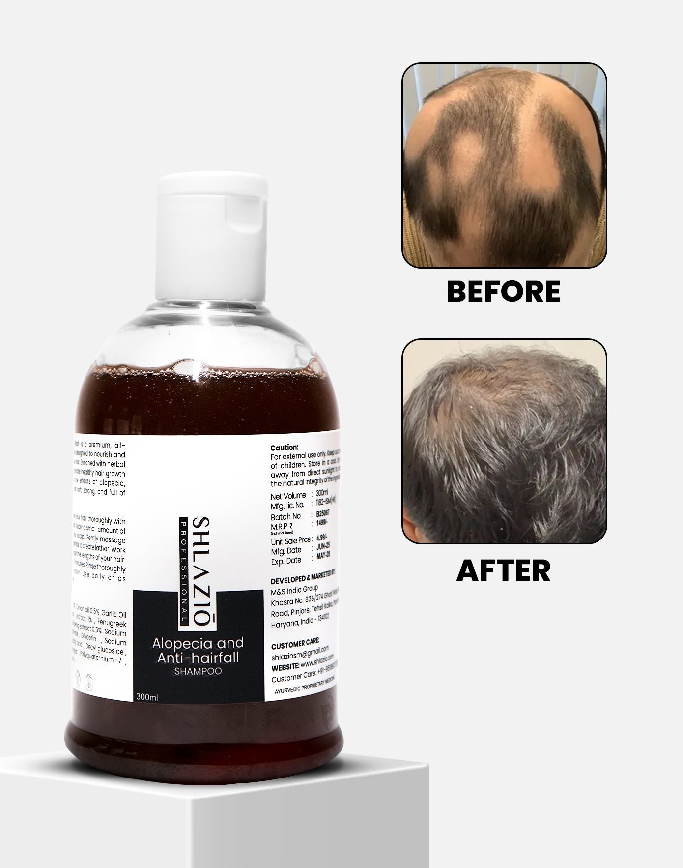 Alopecia and Anti-hair Fall Shampoo | 300 ml
