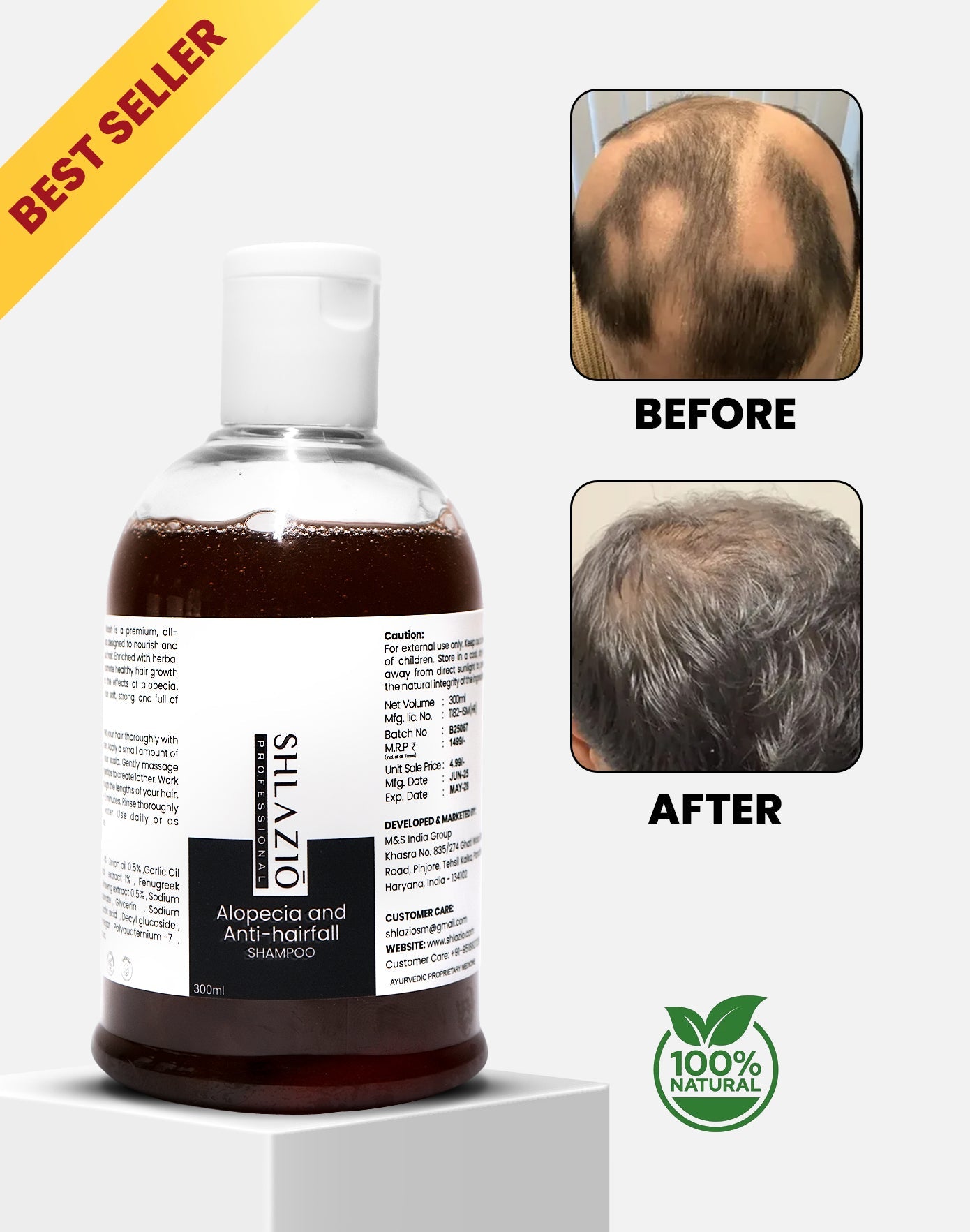 Alopecia and Anti-hair Fall Shampoo | 300 ml
