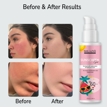 Sunscreen Face gel SPF 60 PA++++ | 100ml