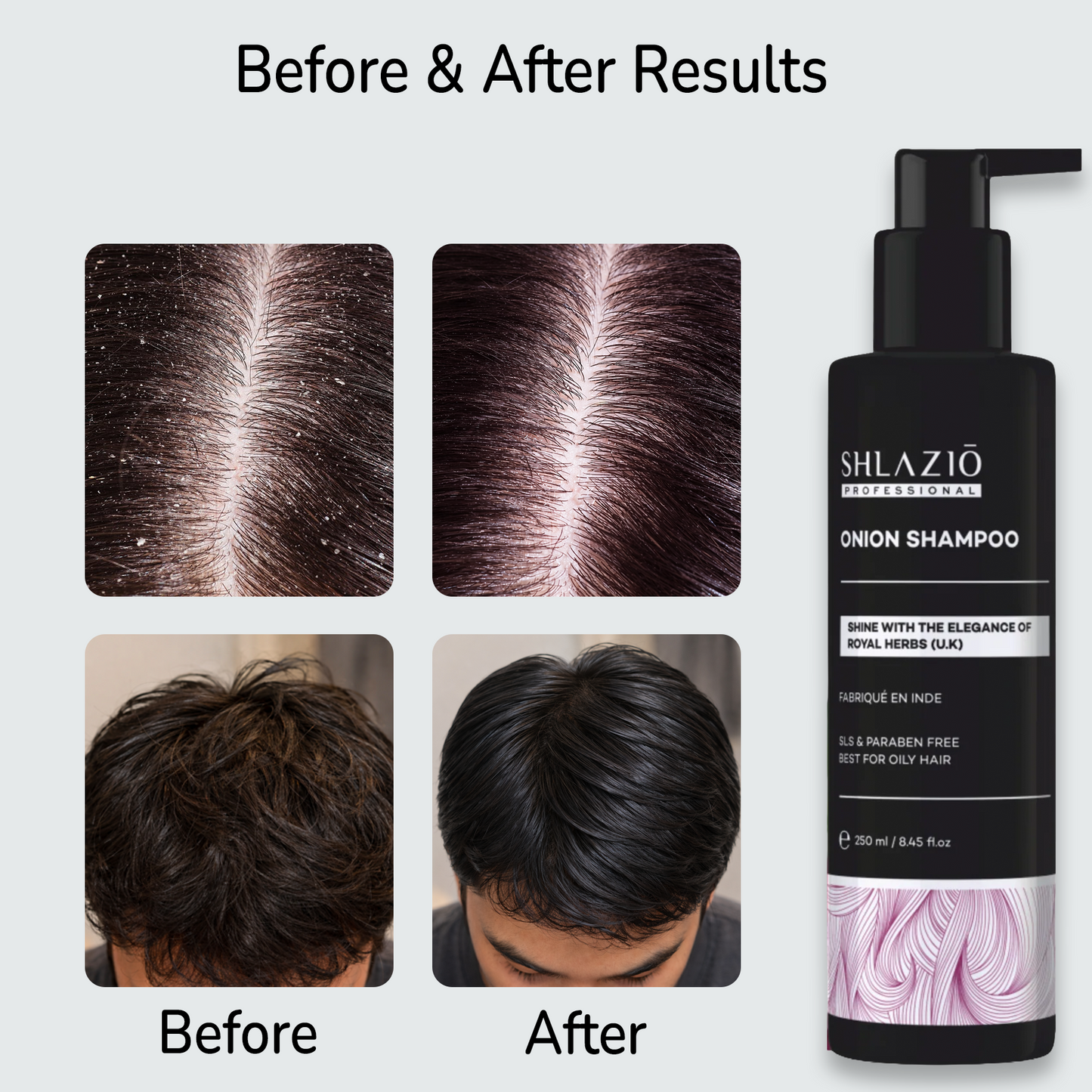 Onion Shampoo | 250ml