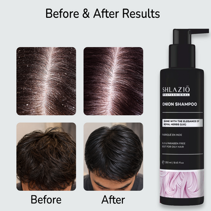 Onion Shampoo | 250ml
