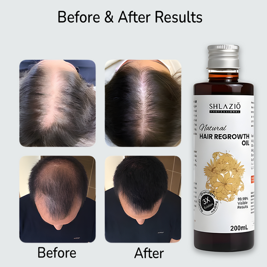 Natural Hair Regrowth Oil 200 ML
