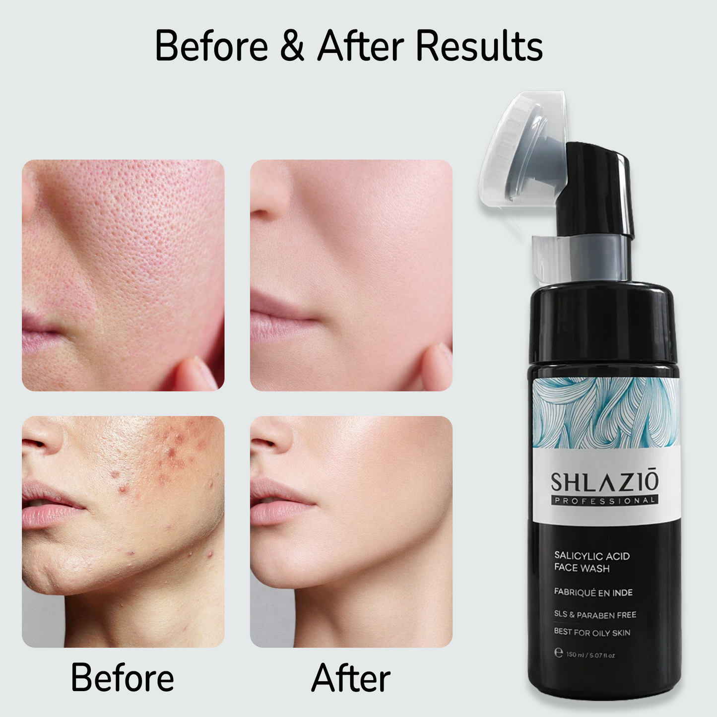 Salicylic Acid Face Wash 150 ML