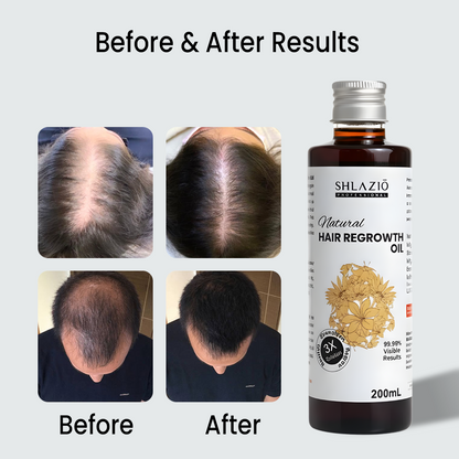 Natural Hair Regrowth Oil 200 ML