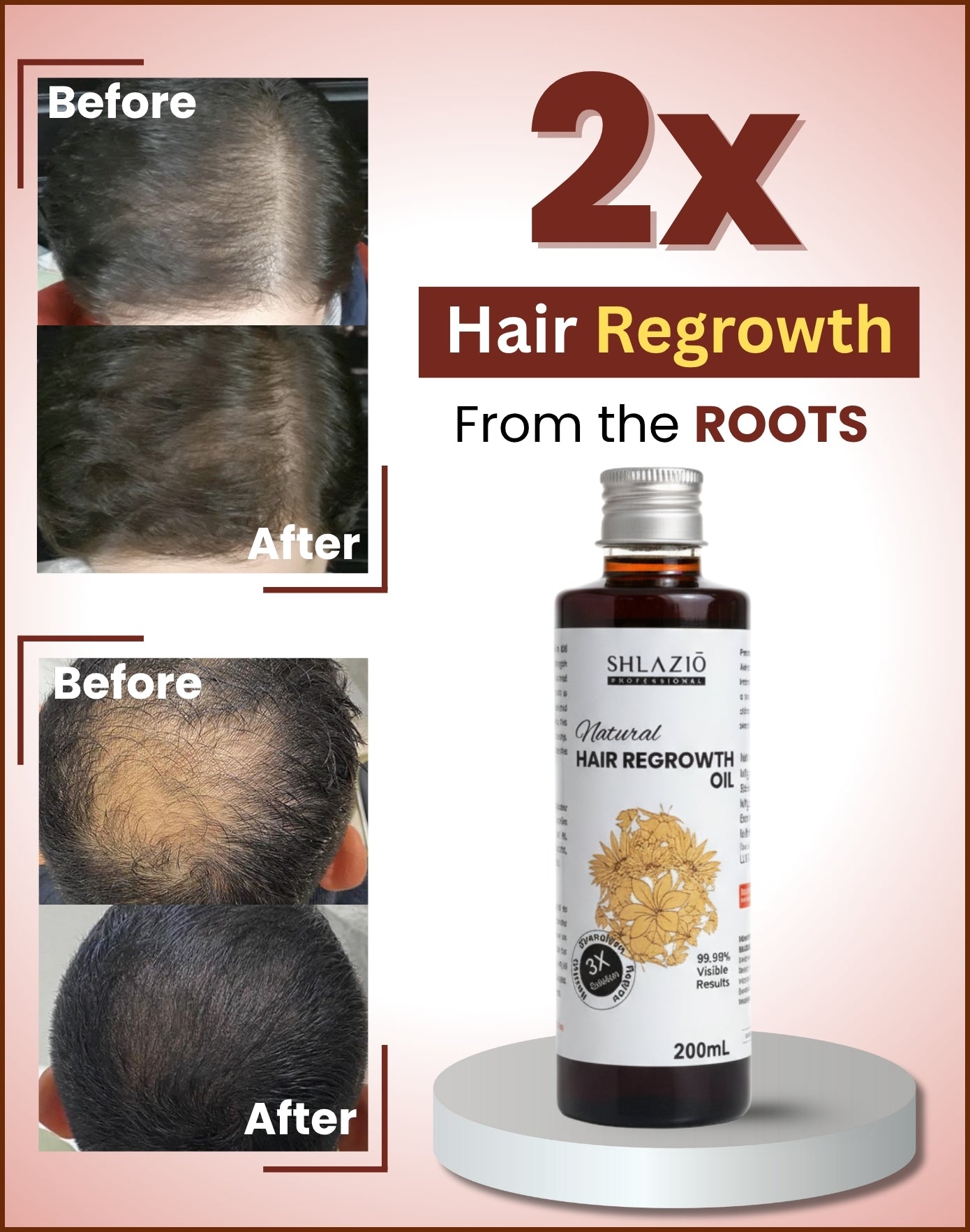 Natural Hair Regrowth Oil 200 ML