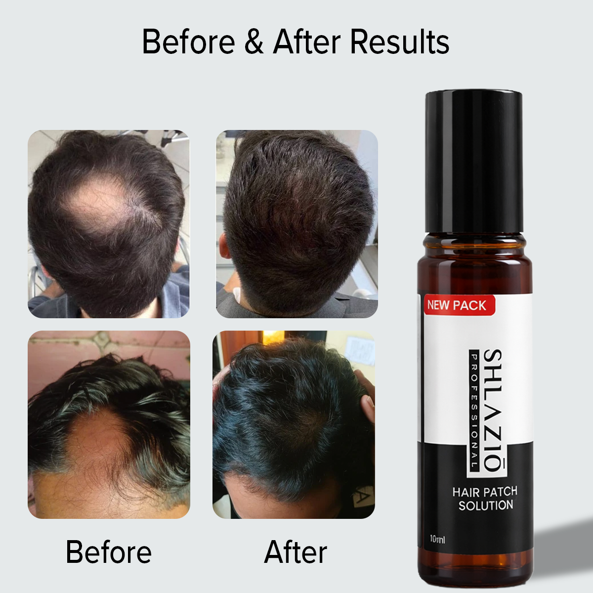 Alopecia Hair Patch Roll - On | #1 Highly Rated & Effective Formula