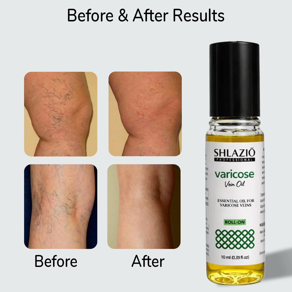 Natural Varicos Vein Oil | Roll On 10ml