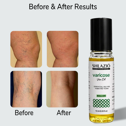 Natural Varicos Vein Oil | Roll On 10ml