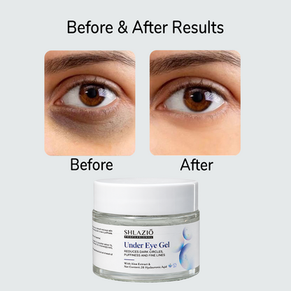 Shlazio Under Eye Gel