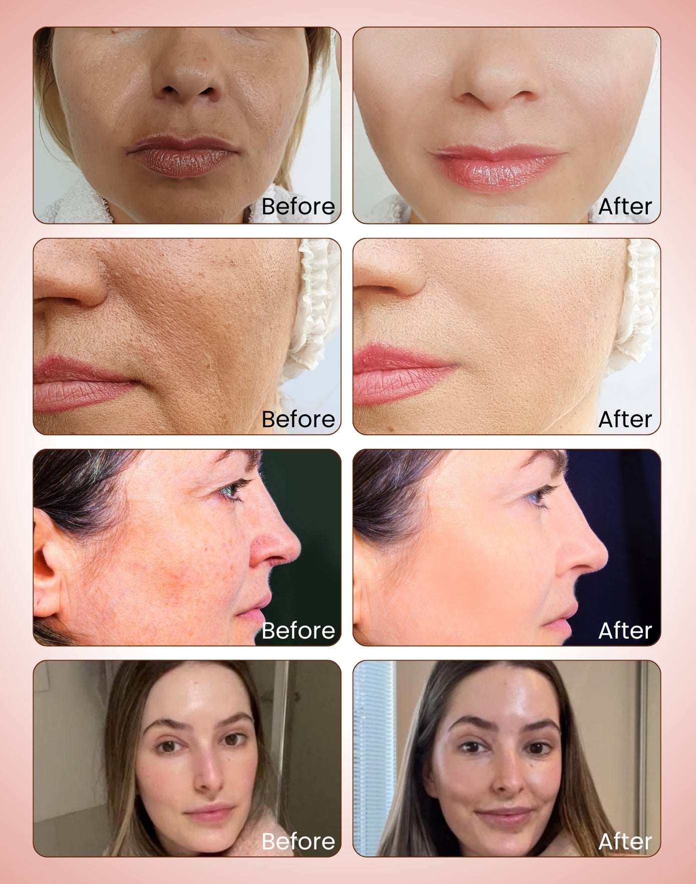 Kumkumadi Oil | 30ml (With Goodness of Safron)